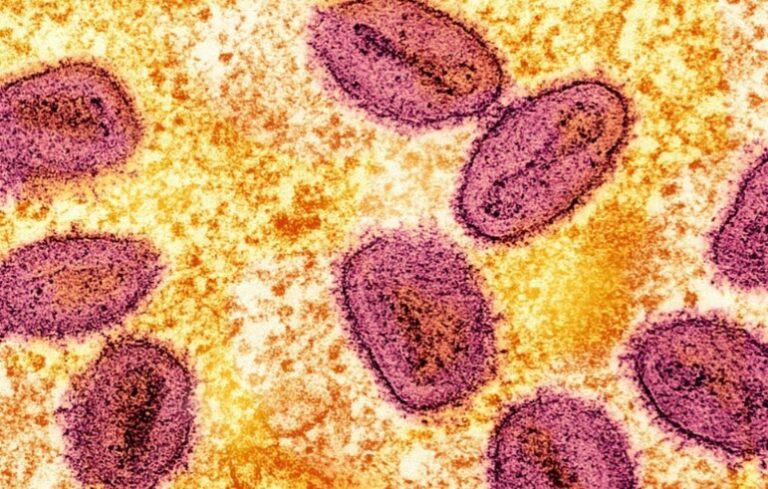 Una micrografía electrónica de transmisión coloreada sin fecha de partículas del virus mpox (rosa) encontradas dentro de una célula infectada (amarilla) Foto: archivos de Reuters